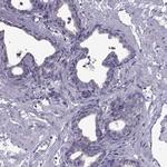 PABPC1 Antibody in Immunohistochemistry (Paraffin) (IHC (P))