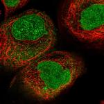 KPNA4 Antibody in Immunocytochemistry (ICC/IF)