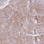 KPNA4 Antibody in Immunohistochemistry (Paraffin) (IHC (P))