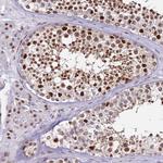 KPNA4 Antibody in Immunohistochemistry (Paraffin) (IHC (P))