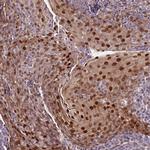 KPNA4 Antibody in Immunohistochemistry (Paraffin) (IHC (P))