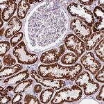 NF1 Antibody in Immunohistochemistry (Paraffin) (IHC (P))