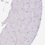 NF1 Antibody in Immunohistochemistry (Paraffin) (IHC (P))