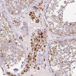 NF1 Antibody in Immunohistochemistry (Paraffin) (IHC (P))