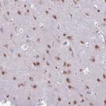 Nova-2 Antibody in Immunohistochemistry (Paraffin) (IHC (P))