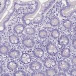 Nova-2 Antibody in Immunohistochemistry (Paraffin) (IHC (P))