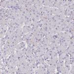 Nova-2 Antibody in Immunohistochemistry (Paraffin) (IHC (P))