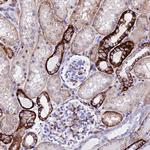 CRP2 Antibody in Immunohistochemistry (Paraffin) (IHC (P))