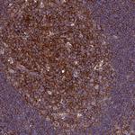 CRP2 Antibody in Immunohistochemistry (Paraffin) (IHC (P))