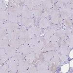 CRP2 Antibody in Immunohistochemistry (Paraffin) (IHC (P))