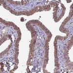 NPEPPS Antibody in Immunohistochemistry (Paraffin) (IHC (P))