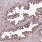 NPEPPS Antibody in Immunohistochemistry (Paraffin) (IHC (P))