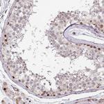 DPH2 Antibody in Immunohistochemistry (Paraffin) (IHC (P))