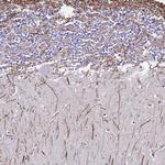 DLX1 Antibody in Immunohistochemistry (Paraffin) (IHC (P))