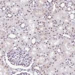 PTPN2 Antibody in Immunohistochemistry (Paraffin) (IHC (P))