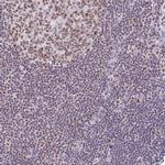 PTPN2 Antibody in Immunohistochemistry (Paraffin) (IHC (P))