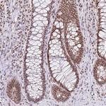 PTPN2 Antibody in Immunohistochemistry (Paraffin) (IHC (P))