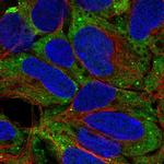 Cardiac Troponin I Antibody in Immunocytochemistry (ICC/IF)