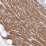 Cardiac Troponin I Antibody in Immunohistochemistry (Paraffin) (IHC (P))