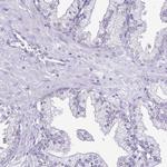 Cardiac Troponin I Antibody in Immunohistochemistry (Paraffin) (IHC (P))