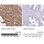 Cardiac Troponin I Antibody