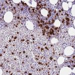 CD177 Antibody in Immunohistochemistry (Paraffin) (IHC (P))