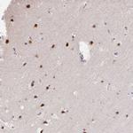 GTF2H1 Antibody in Immunohistochemistry (Paraffin) (IHC (P))