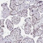 GTF2H1 Antibody in Immunohistochemistry (Paraffin) (IHC (P))