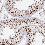 GTF2H1 Antibody in Immunohistochemistry (Paraffin) (IHC (P))