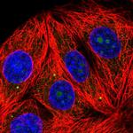 RPL7A Antibody in Immunocytochemistry (ICC/IF)