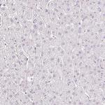 Desmoglein 3 Antibody in Immunohistochemistry (Paraffin) (IHC (P))