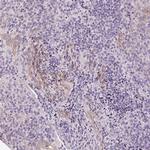 Desmoglein 3 Antibody in Immunohistochemistry (Paraffin) (IHC (P))