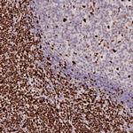 SAMHD1 Antibody in Immunohistochemistry (Paraffin) (IHC (P))