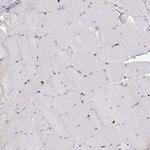 SAMHD1 Antibody in Immunohistochemistry (Paraffin) (IHC (P))