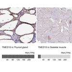 TMP21 Antibody