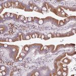 TMP21 Antibody in Immunohistochemistry (Paraffin) (IHC (P))