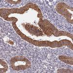 TMP21 Antibody in Immunohistochemistry (Paraffin) (IHC (P))