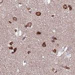 LAP1 Antibody in Immunohistochemistry (Paraffin) (IHC (P))