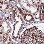 LAP1 Antibody in Immunohistochemistry (Paraffin) (IHC (P))