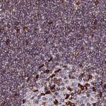 LAP1 Antibody in Immunohistochemistry (Paraffin) (IHC (P))