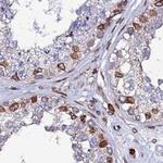 LAP1 Antibody in Immunohistochemistry (Paraffin) (IHC (P))