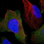 Calcineurin B Antibody in Immunocytochemistry (ICC/IF)