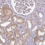 GPX4 Antibody in Immunohistochemistry (Paraffin) (IHC (P))