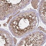 GPX4 Antibody in Immunohistochemistry (Paraffin) (IHC (P))