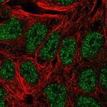 Annexin A8 Antibody in Immunocytochemistry (ICC/IF)