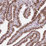 Ku70 Antibody in Immunohistochemistry (Paraffin) (IHC (P))