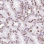 Ku70 Antibody in Immunohistochemistry (Paraffin) (IHC (P))