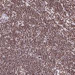 Ku70 Antibody in Immunohistochemistry (Paraffin) (IHC (P))