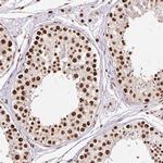 Ku70 Antibody in Immunohistochemistry (Paraffin) (IHC (P))