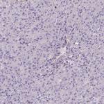 SH2D3C Antibody in Immunohistochemistry (Paraffin) (IHC (P))